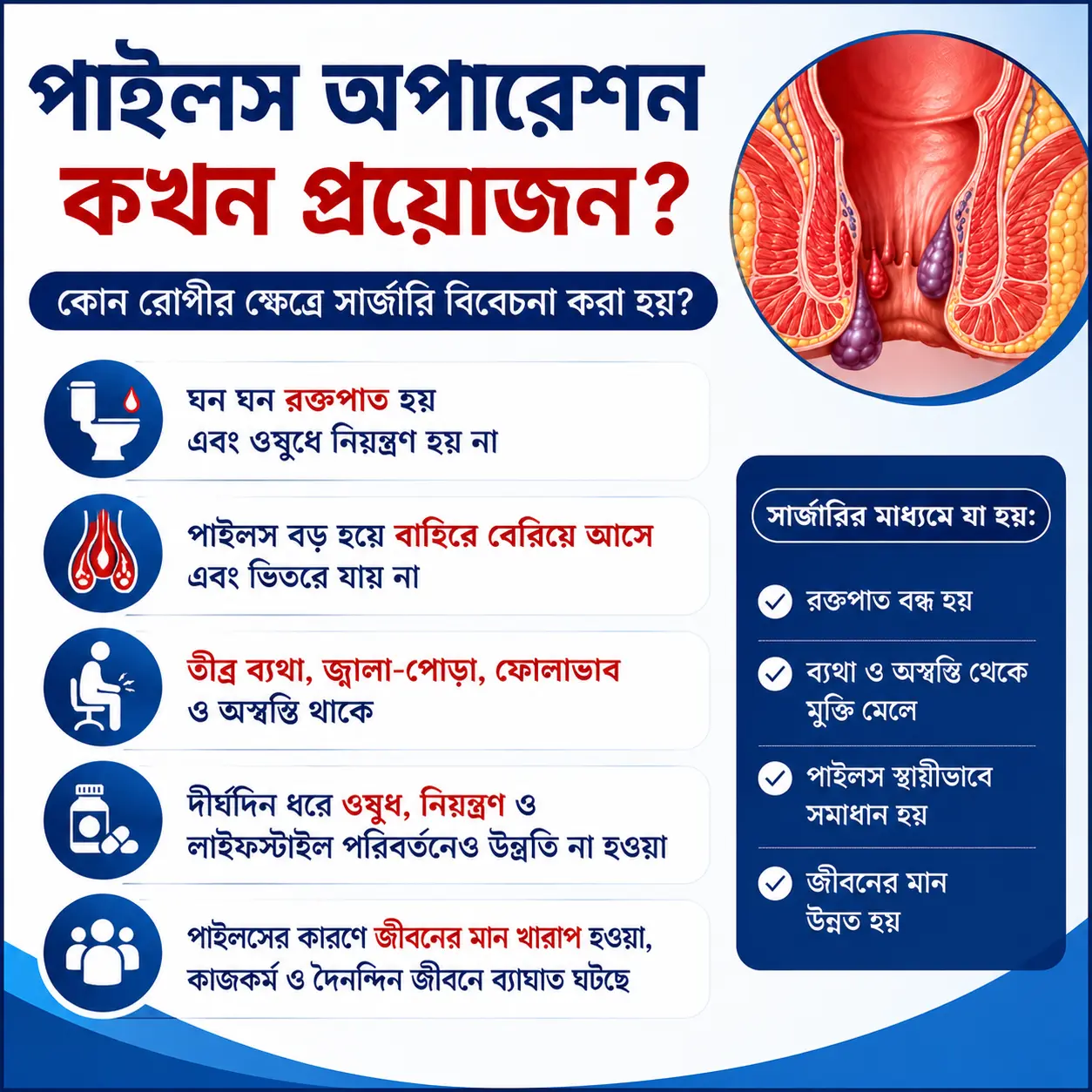 পাইলস অপারেশন কখন প্রয়োজন – ডা. এইচ. এন. এম. শফিকুজ্জামান