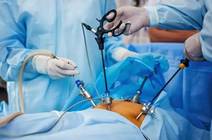 Gallbladder Stone (পিত্তপাথর) অপারেশন| Laparoscopic অপারেশনে ১ দিনে বাড়ি | রাজশাহী